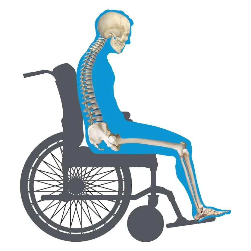 Posterior pelvic tilt wheelchair seating view